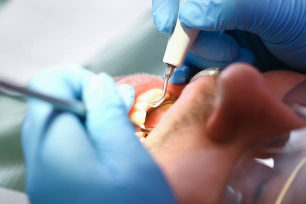 Best Emergency Dental Care for Broken or Chipped Teeth in Nicollet, MN