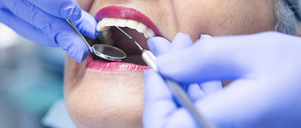 Best Emergency Treatment for Dental Infections or Abscesses in Nicollet, MN